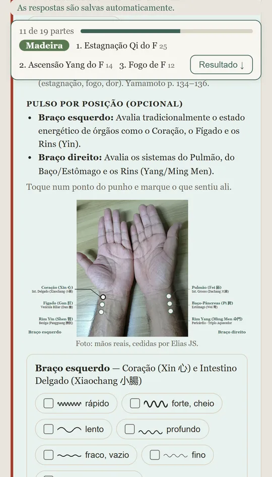 Pulso por posição