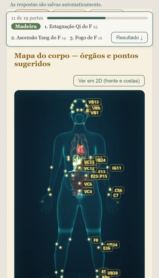Mapa do corpo em 3D com os pontos sugeridos para uma paciente de exemplo