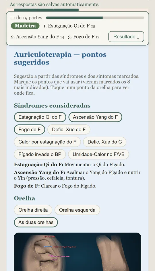 Auriculoterapia na ficha